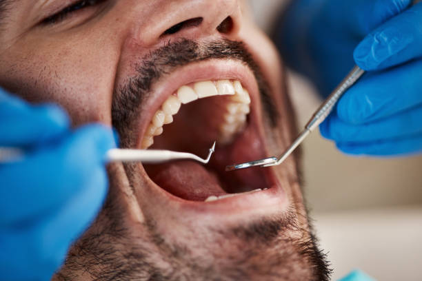 Laser Dentistry in Manasquan, NJ